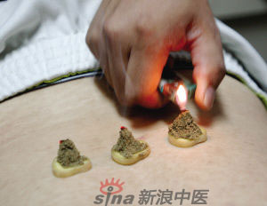 灸法的種類  你知道多少？