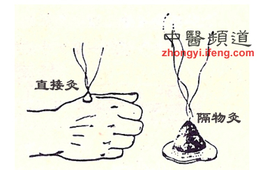 點擊將在新窗口查看全圖 溫補脾胃用艾灸 男女老少都適用