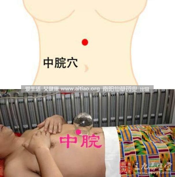 中脘穴位于腹部正中線，臍上4寸的位置上。每天艾灸10-15分鐘，能有效緩解胃部不適的癥狀，同時有助于祛濕。